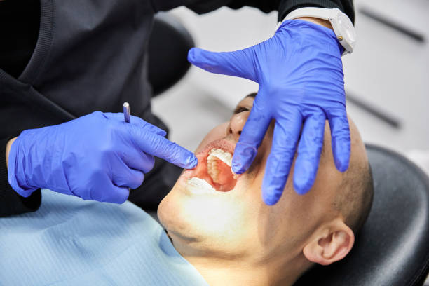 Best Knocked-Out Tooth Emergency  in Hannibal, MO