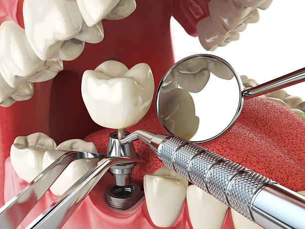 Best Tooth Infection Emergency Dentist  in Hannibal, MO